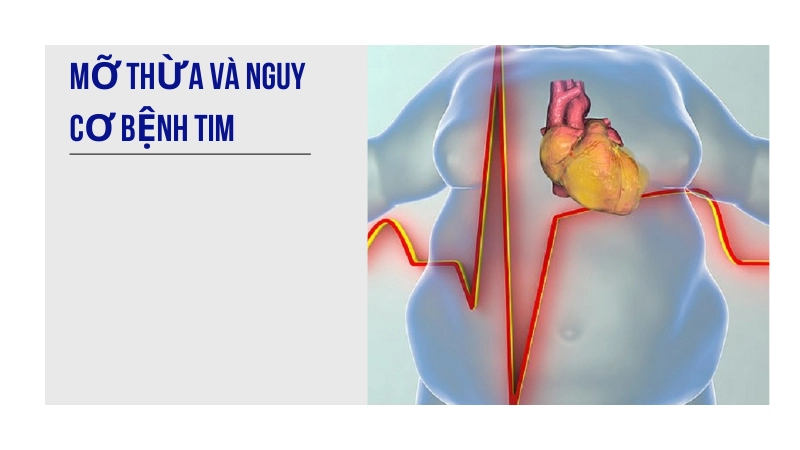 Mỡ thừa tăng nguy cơ bệnh tim mạch 