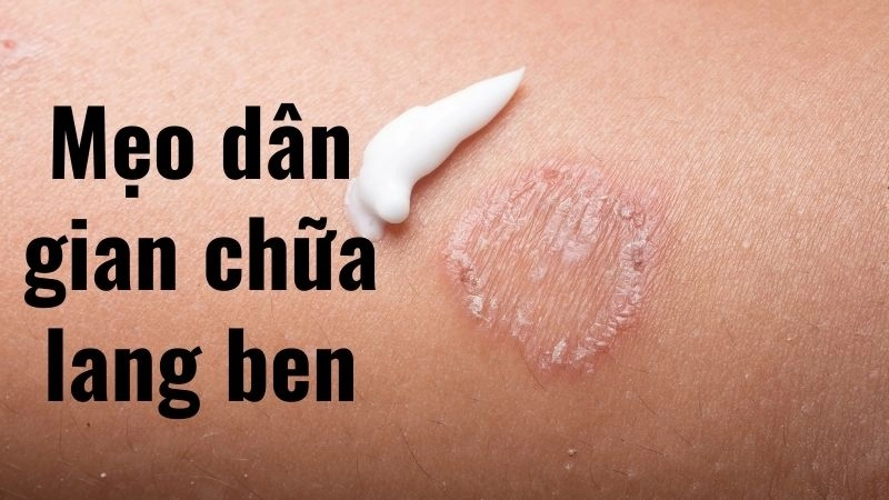 Sức mạnh diệt nấm từ củ tỏi trong gian bếp